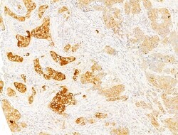 Phospho-Acetyl-CoA Carboxylase (Ser80) Polyclonal Antibody, Invitrogen