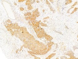 Phospho-Acetyl-CoA Carboxylase (Ser80) Polyclonal Antibody, Invitrogen