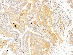 Phospho-Acetyl-CoA Carboxylase (Ser80) Polyclonal Antibody, Invitrogen