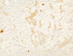 Phospho-Acetyl-CoA Carboxylase (Ser80) Polyclonal Antibody, Invitrogen