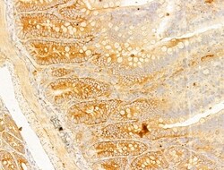 Phospho-Acetyl-CoA Carboxylase (Ser80) Polyclonal Antibody, Invitrogen