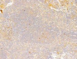 Phospho-Acetyl-CoA Carboxylase (Ser80) Polyclonal Antibody, Invitrogen