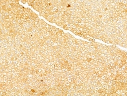 Phospho-Acetyl-CoA Carboxylase (Ser80) Polyclonal Antibody, Invitrogen