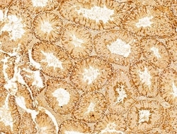 Phospho-Acetyl-CoA Carboxylase (Ser80) Polyclonal Antibody, Invitrogen