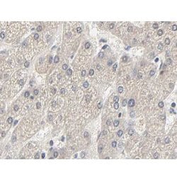Phospho-Acetyl-CoA Carboxylase (Ser80) Polyclonal Antibody, Invitrogen
