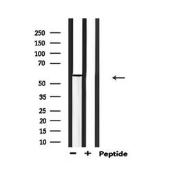 Invitrogen Phospho-PAK1 (Thr212) Polyclonal Antibody 100 μL; Unconjugated:Antibodies,