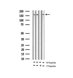 Invitrogen Phospho-NMDAR2B (Tyr1474) Polyclonal Antibody 100 &mu;L; Unconjugated:Antibodies,
