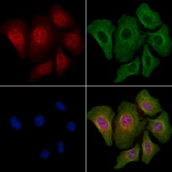 Invitrogen Phospho-4EBP1 (Thr36) Polyclonal Antibody 100 &mu;L; Unconjugated:Antibodies,