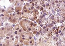 Invitrogen Phospho-4EBP1 (Thr36) Polyclonal Antibody 100 &mu;L; Unconjugated:Antibodies,