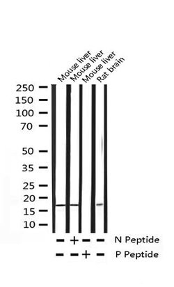 Invitrogen Phospho-4EBP1 (Thr36) Polyclonal Antibody 100 &mu;L; Unconjugated:Antibodies,