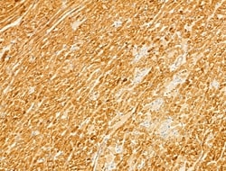 Invitrogen Phospho-CaMKII beta/gamma/delta (Thr287) Polyclonal Antibody