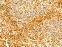 Invitrogen Phospho-CaMKII beta/gamma/delta (Thr287) Polyclonal Antibody