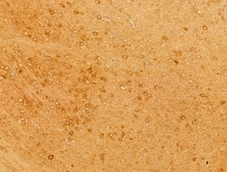 Invitrogen Phospho-CaMKII beta/gamma/delta (Thr287) Polyclonal Antibody