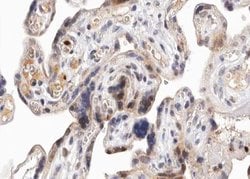 Invitrogen Phospho-PKD1/2/3/PKC mu (Ser738, Ser742) Polyclonal Antibody