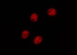 Invitrogen Phospho-IkappaB beta (Ser23) Polyclonal Antibody 100 &mu;L;