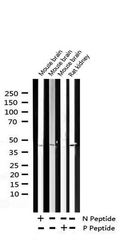 Invitrogen Phospho-IkappaB beta (Ser23) Polyclonal Antibody 100 &mu;L;