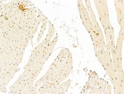 Invitrogen Phospho-SMAD2 (Ser467) Polyclonal Antibody 100 &mu;L; Unconjugated:Antibodies,