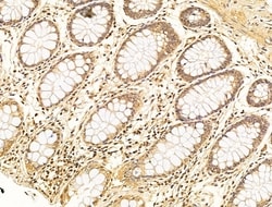 Invitrogen Phospho-SMAD2 (Ser467) Polyclonal Antibody 100 &mu;L; Unconjugated:Antibodies,