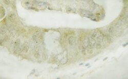 Invitrogen Phospho-LKB1 (Ser428) Polyclonal Antibody 100 μL; Unconjugated:Antibodies,