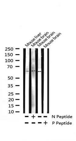 Invitrogen Phospho-LKB1 (Thr189) Polyclonal Antibody 100 &mu;L | Buy Online | Invitrogen&trade; | Fisher Scientific