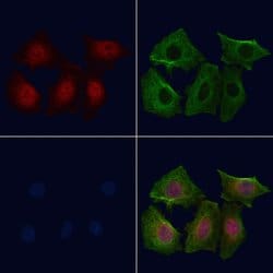 Invitrogen Phospho-p38 MAPK alpha (Tyr323) Polyclonal Antibody 100 &mu;L;