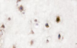 Invitrogen Phospho-p38 MAPK alpha (Tyr323) Polyclonal Antibody 100 &mu;L;