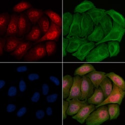 Invitrogen Phospho-CAMKIV (Thr200) Polyclonal Antibody 100 &mu;L; Unconjugated:Antibodies,