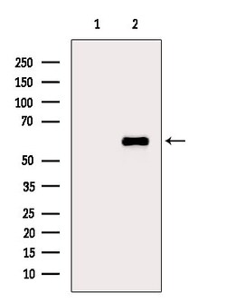 Invitrogen Phospho-CAMKIV (Thr200) Polyclonal Antibody 100 &mu;L; Unconjugated:Antibodies,