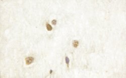 Invitrogen Phospho-CAMKIV (Thr200) Polyclonal Antibody 100 &mu;L; Unconjugated:Antibodies,