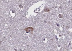 Invitrogen Phospho-TRKB (Tyr706) Polyclonal Antibody 100 &mu;L; Unconjugated:Antibodies,