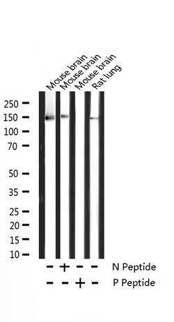 Invitrogen Phospho-TRKB (Tyr706) Polyclonal Antibody 100 &mu;L; Unconjugated:Antibodies,