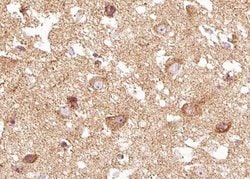 Invitrogen Phospho-TRKB (Tyr516) Polyclonal Antibody 100 &mu;L; Unconjugated:Antibodies,