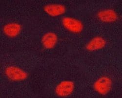 Invitrogen Phospho-ESR2 (Ser105) Polyclonal Antibody 100 &mu;L; Unconjugated:Antibodies,