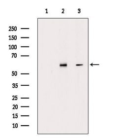 Invitrogen Phospho-ESR2 (Ser105) Polyclonal Antibody 100 &mu;L; Unconjugated:Antibodies,