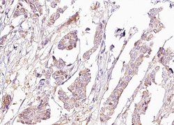 Invitrogen Phospho-BAD (Ser118) Polyclonal Antibody 100 &mu;L; Unconjugated:Antibodies,
