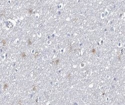 Invitrogen Phospho-CPI-17 (Thr38) Polyclonal Antibody 100 &mu;L; Unconjugated:Antibodies,