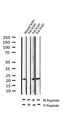 Invitrogen Phospho-CPI-17 (Thr38) Polyclonal Antibody 100 &mu;L; Unconjugated:Antibodies,