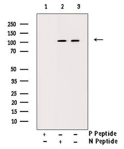 Invitrogen Phospho-SIRT1 (Ser47) Polyclonal Antibody 100 &mu;L; Unconjugated:Antibodies,