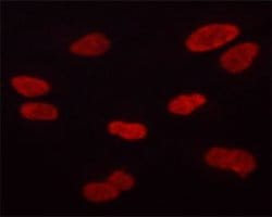 Invitrogen&trade;&nbsp;Phospho-Aurora B (Thr232) Polyclonal Antibody