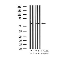 Invitrogen Phospho-DOK1 (Tyr362) Polyclonal Antibody 100 &mu;L; Unconjugated:Antibodies,