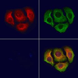 Invitrogen Phospho-DOK1 (Tyr398) Polyclonal Antibody 100 &mu;L; Unconjugated:Antibodies,
