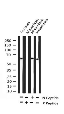 Invitrogen Phospho-DOK1 (Tyr398) Polyclonal Antibody 100 &mu;L; Unconjugated:Antibodies,