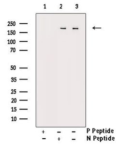 Invitrogen Phospho-FANCD2 (Ser222) Polyclonal Antibody 100 &mu;L | Buy Online | Invitrogen&trade; | Fisher Scientific