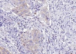 Invitrogen Phospho-WNK1 (Thr60) Polyclonal Antibody 100 &mu;L; Unconjugated:Antibodies,