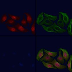 Invitrogen Phospho-HDAC6 (Ser22) Polyclonal Antibody 100 &mu;L; Unconjugated:Antibodies,