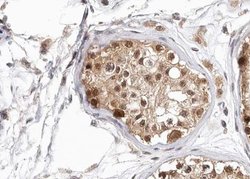 Invitrogen Phospho-HDAC6 (Ser22) Polyclonal Antibody 100 &mu;L; Unconjugated:Antibodies,