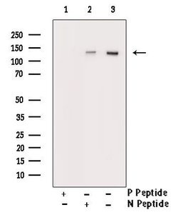 Invitrogen Phospho-HDAC6 (Ser22) Polyclonal Antibody 100 &mu;L; Unconjugated:Antibodies,