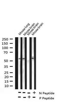 Invitrogen Phospho-RPS6KB2 (Ser423) Polyclonal Antibody 100 &mu;L; Unconjugated:Antibodies,