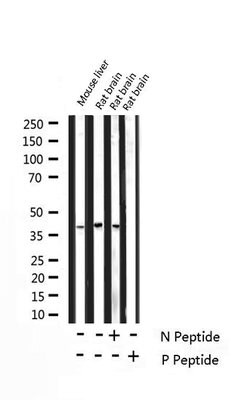 Invitrogen Phospho-DARPP-32 (Thr75) Polyclonal Antibody 100 &mu;L; Unconjugated:Antibodies,