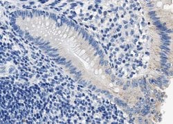 Invitrogen Phospho-DARPP-32 (Thr34) Polyclonal Antibody 100 &mu;L; Unconjugated:Antibodies,